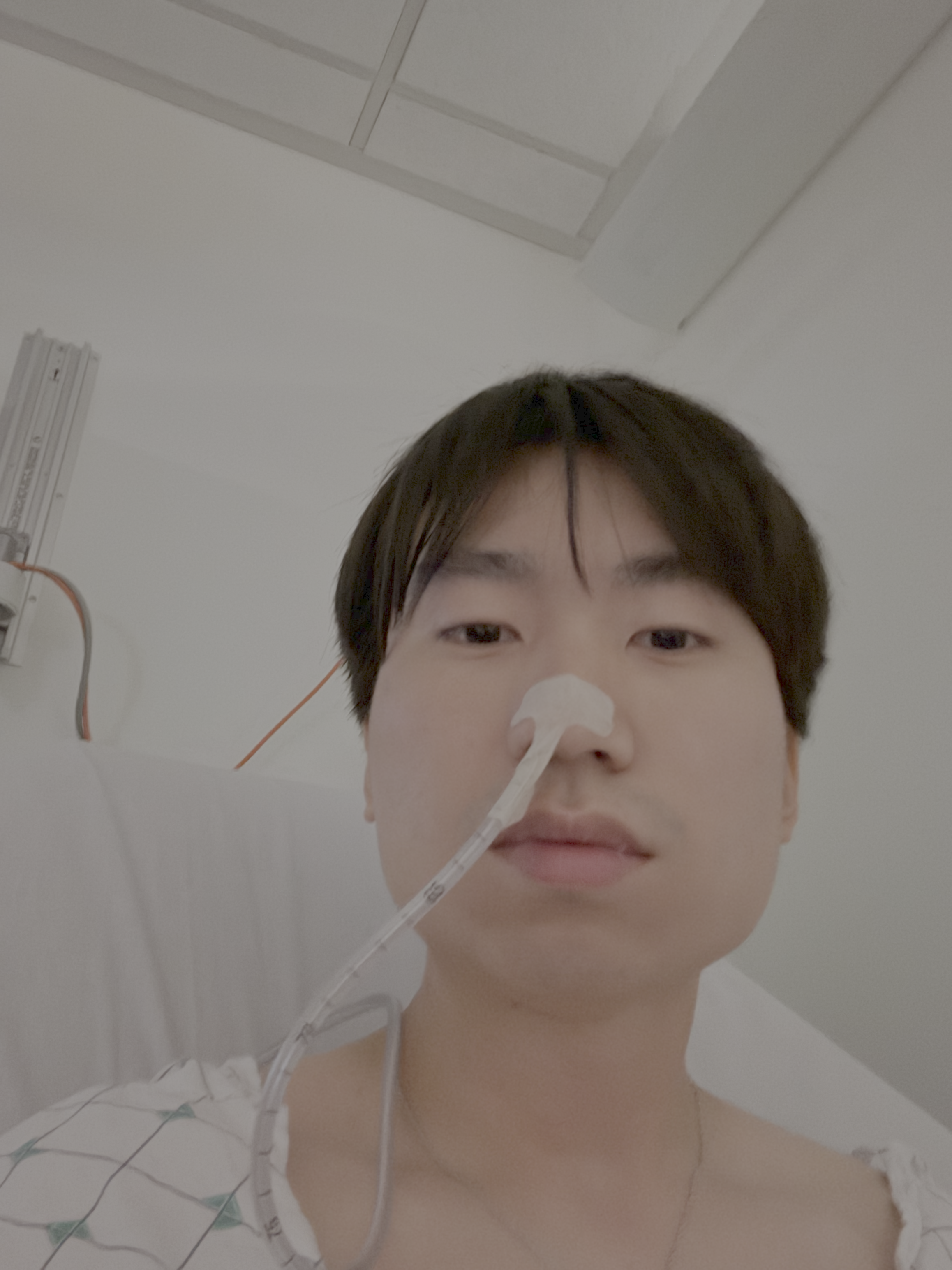 Selfie of me with NG tube